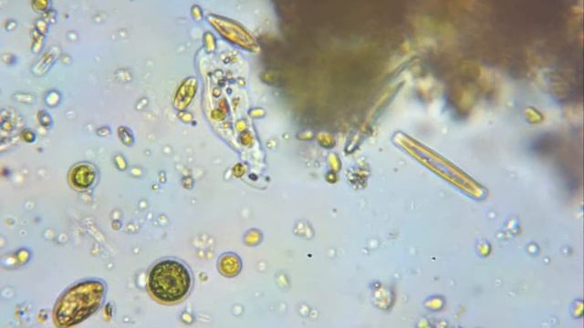 Amoeba ( species : Saccamoeba ).avi смотреть онлайн