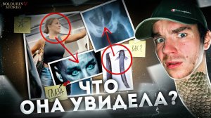 Что происходит В САМОЛЕТАХ?У парня нашли РЫБКУ между ног😱Страшные истории