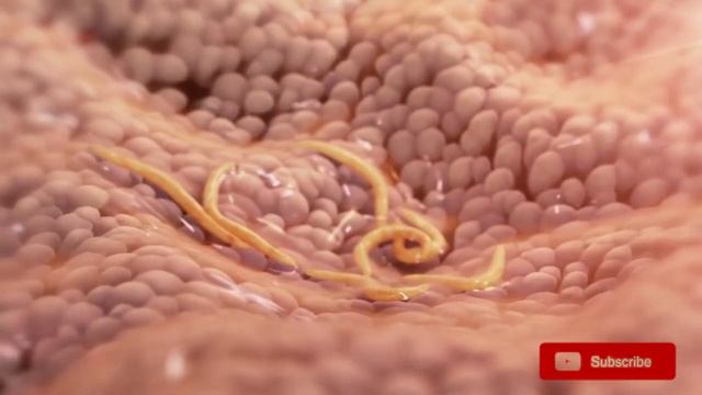 Worst Parasites!  Mangoworms, Ticks, Tunga Penetrans, Tapeworms!