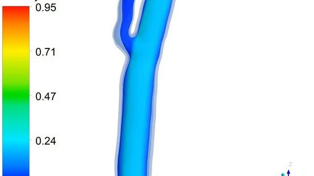 Thesis FSI Carotid 3 - z-plane velocity - ANSYS смотреть онлайн
