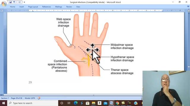 Surgical infections in Arabic 7 ( Hand Infections, part 3 ) , by Dr. Wahdan смотреть онлайн