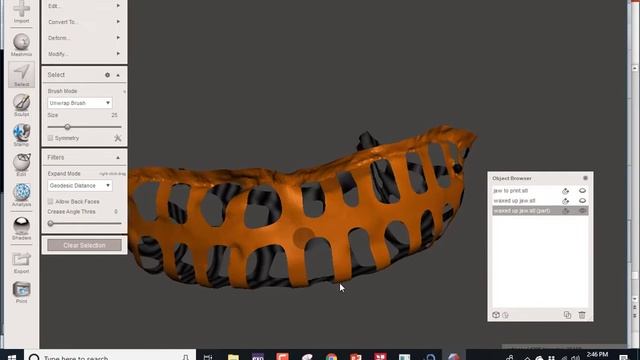 custom titanium grafting mesh смотреть онлайн