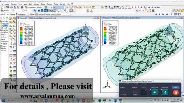Modelling Degradation in Biodegradable PLA bone plates & vascular stents with Abaqus via VUSDFLD смотреть онлайн