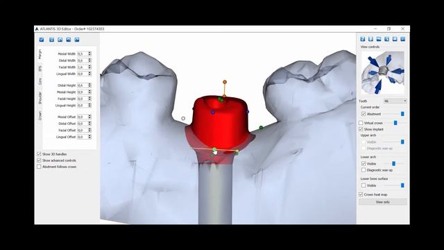 Atlantis Editor design approval смотреть онлайн