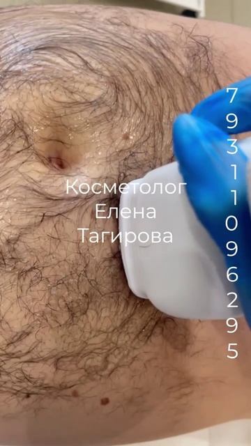 Липосоникс от Елены Тагировой смотреть онлайн