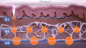 Альтератерапия