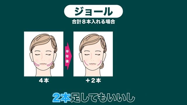 【糸リフト】どれくらいの間隔で受けたらいい？ смотреть онлайн