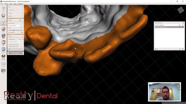 Reality Dental - Diseño 3D de Ferula o Splint Dental con Autodesk Meshmixer смотреть онлайн