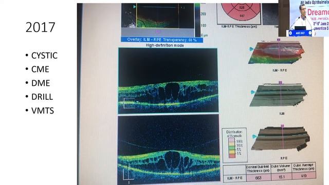 AIOC2022 GP28 topic DR DUDANI AJAY INDUR Correlating clinical and investigating cardinal feature 2 смотреть онлайн