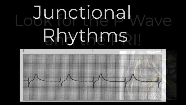 8 Junctional rhythms смотреть онлайн