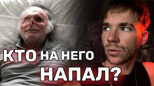 Потерял ЛИЦО после НАПАДЕНИЯ.😱Жуткие истории.