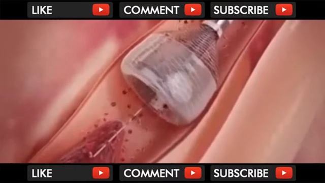 New technology in medical field смотреть онлайн