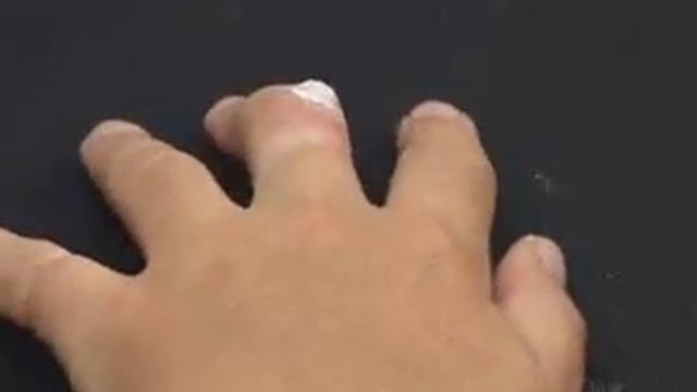 Home Wart Removal  - Easy Wart Remover - Mole & Wart EZ Clear