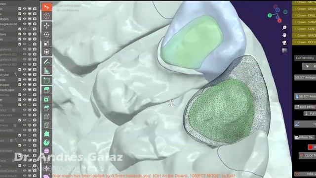 Diseño Coronas Anteriores - Dental Design in Blender for Dental смотреть онлайн