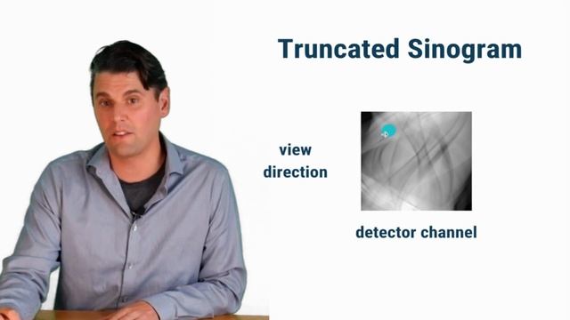 Truncation artifacts in CT смотреть онлайн