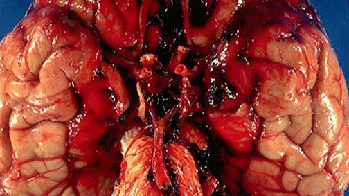 Простые нарушения кровообращения смотреть онлайн