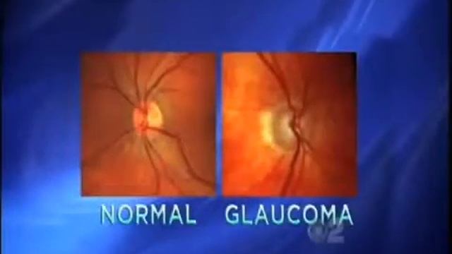 Dr. Will Christian On The Doctors - The Vanguard Eye Institute смотреть онлайн