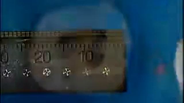 Обзор Protaper Retreatment и Методика работы смотреть онлайн