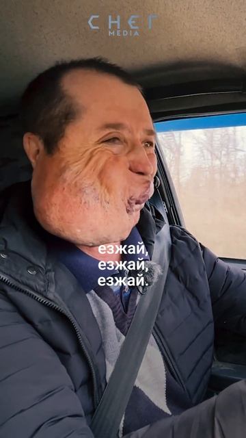 Жить с необычным лицом смотреть онлайн