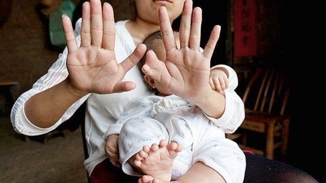 Родился МЛАДЕНЕЦ с 31 пальцем на руках и ногах! смотреть онлайн