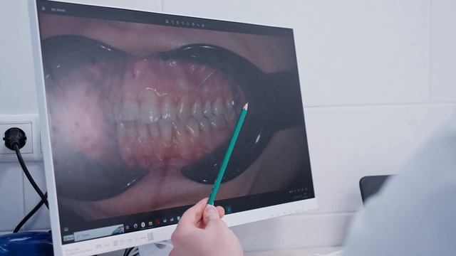 Первичная консультация смотреть онлайн