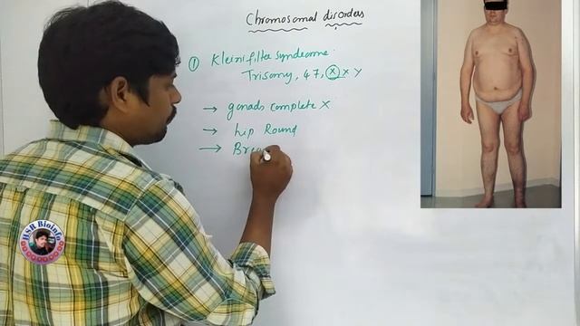 Chromosomal Disorders-3 | Kleinifilter syndrome | Genetics| HSR Bioinfo смотреть онлайн