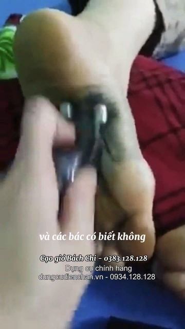 90% mắc phải là do hàn khí Bọ cạp bạc Bách Chi смотреть онлайн
