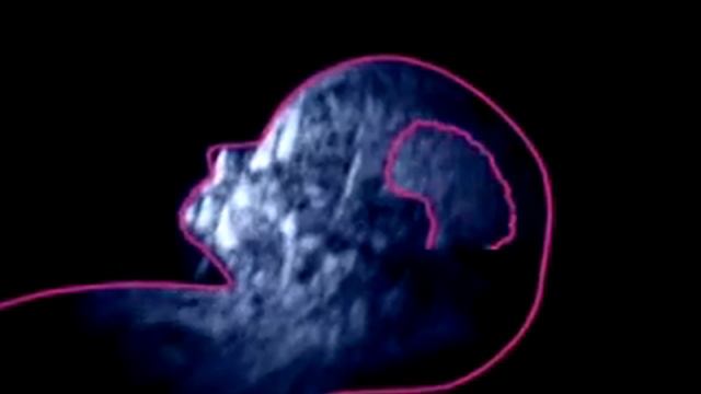 Внутриутробное развитие младенца - Третий месяц смотреть онлайн