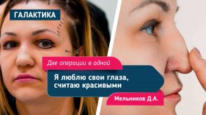 Закрытая риносептопластика и периорбитопластика | Мельников Дмитрий Александрович