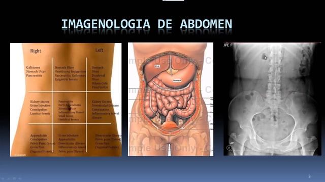 Rx abdomen 1a parte смотреть онлайн