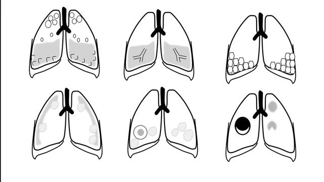 Crack the Core Exam 2018 (5th Edition) смотреть онлайн