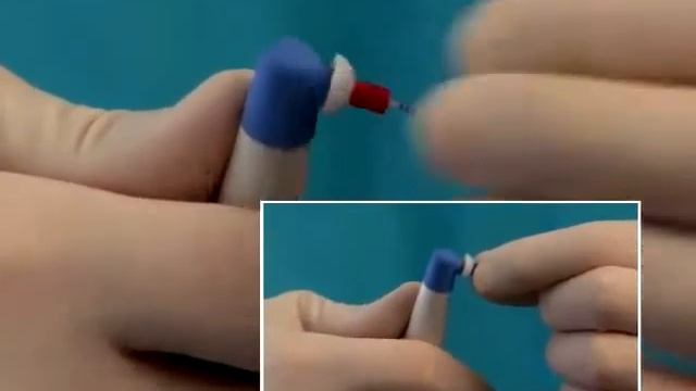 Обзор - Эндодонтия EndoActivator смотреть онлайн