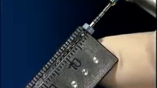 Обзор Protaper Universal и Методика работы смотреть онлайн