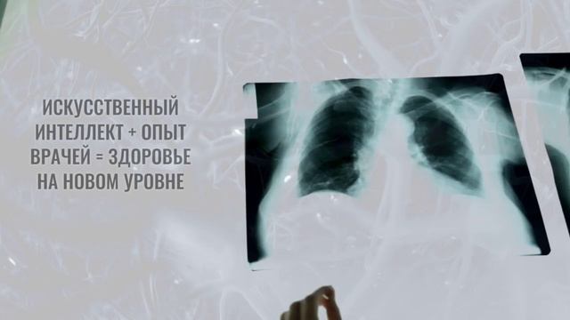 Астраханские врачи тестируют технологии искусственного интеллекта для расшифровки флюорографии смотреть онлайн