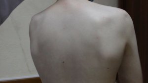 Сравнительная (2) и топографическая перкуссия легких