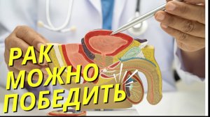 РАК ПРОСТАТЫ – Это НЕ приговор! Новейшие открытия в лечении