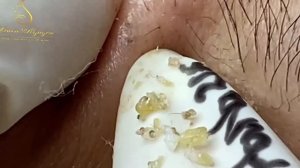 Relax Every Day With Spa Loan Nguyen NEW #36