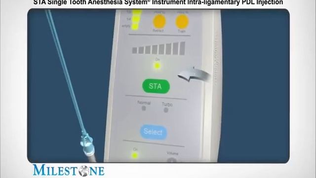 CompuDent STA Компьютерная анестезия | Обзор смотреть онлайн