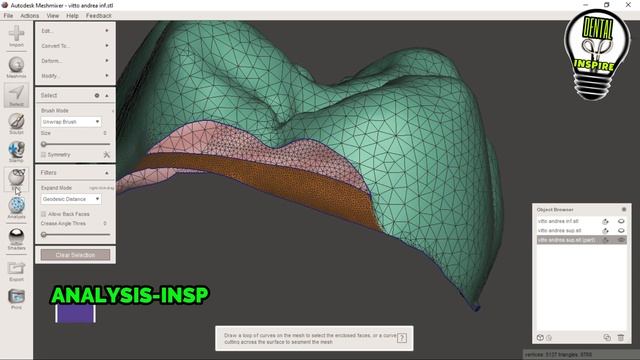 MESHMIXER DENTAL: PROVVISORIO PRELIMATURA смотреть онлайн