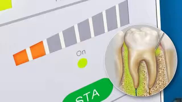 Функциональные возможности STA Compudent | Обзор смотреть онлайн