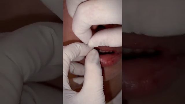 lip piercing #lippiercing #piercing #piercings #piercingcheck #piercinglovers #piercingstudio #pier смотреть онлайн