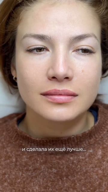 История, которая может случиться только  @dr.beautysense. И ведь нормальные губы были, не поспоришь