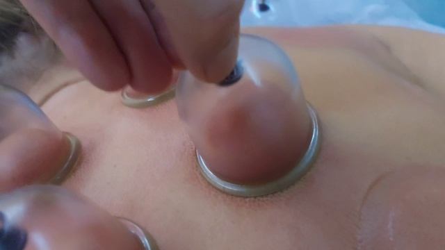 вакуумная профилактика смотреть онлайн