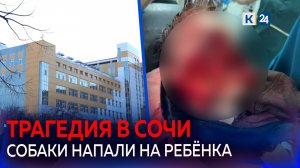 В Сочи собаки разорвали лицо девятилетнему мальчику