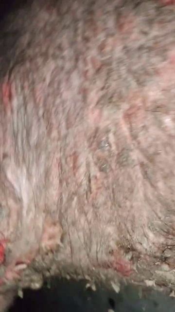 Eczema in buffalo смотреть онлайн