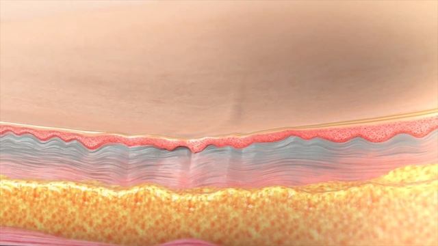 Inmode Morpheus 8 - Клиника профессора Юцковской