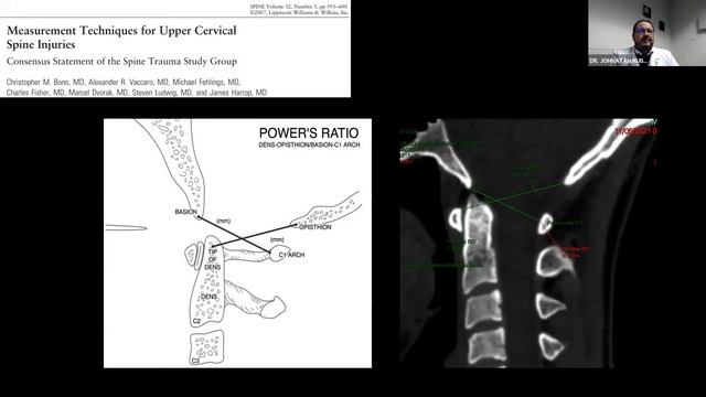 3 - 2 Valoración de la unión cráneo-cervical | Dr. Rubalcava смотреть онлайн