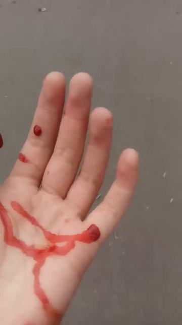 СТРАШНО！КОТЕНОК ПОЦАРАПАЛ РУКУ ДЕВОЧКЕ！ПАВЛОДАР！КРОВЬ ОТ КОТЕНКА！ смотреть онлайн