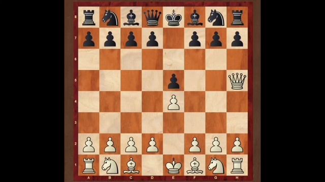 Шахматы для начинающих. Детский мат смотреть онлайн