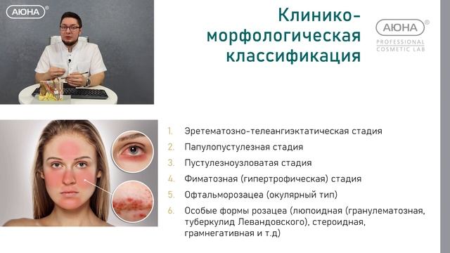 Купероз и розация